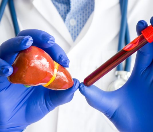 Cum reduci nivelul enzimei ALT